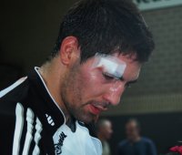 Trotz genähter Platzwunde noch sieben Treffer im Hinspiel: Nikola Karabatic. Trotz genähter Platzwunde noch sieben Treffer im Hinspiel: Nikola Karabatic.