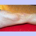 Filip Jicha in der Reha.